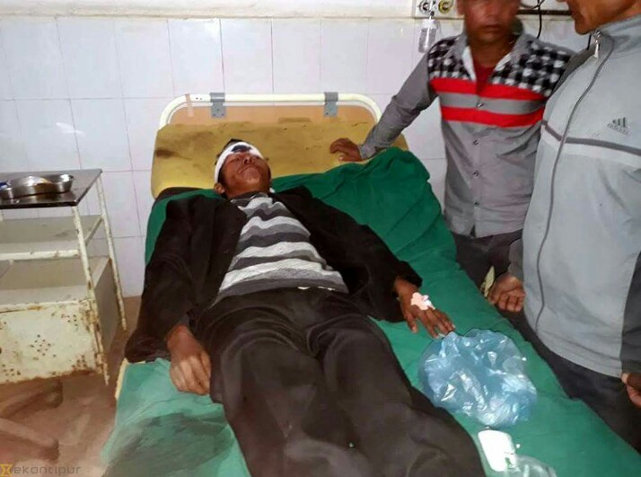 बम बिस्फोटमा परि नेपाल प्रहरी र म्यादी प्रहरी घाइते