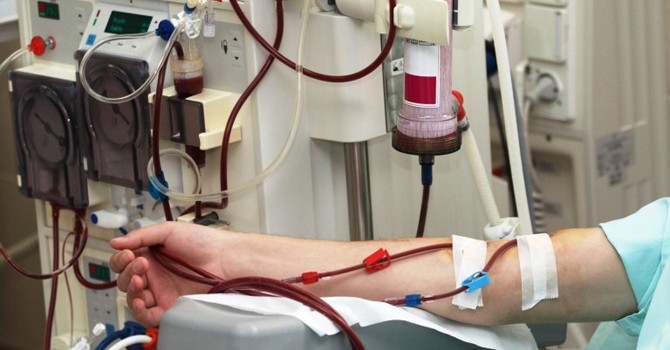 चार वर्षमा २४ हजार नौ सय पटक डायलासिस