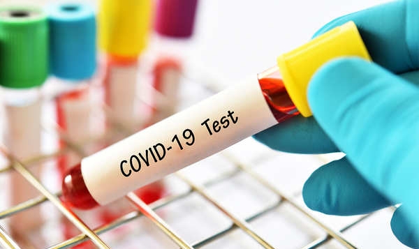 अबदेखि १५ हजार शुल्क तिरेर कोरोना परीक्षण गर्न पाइने